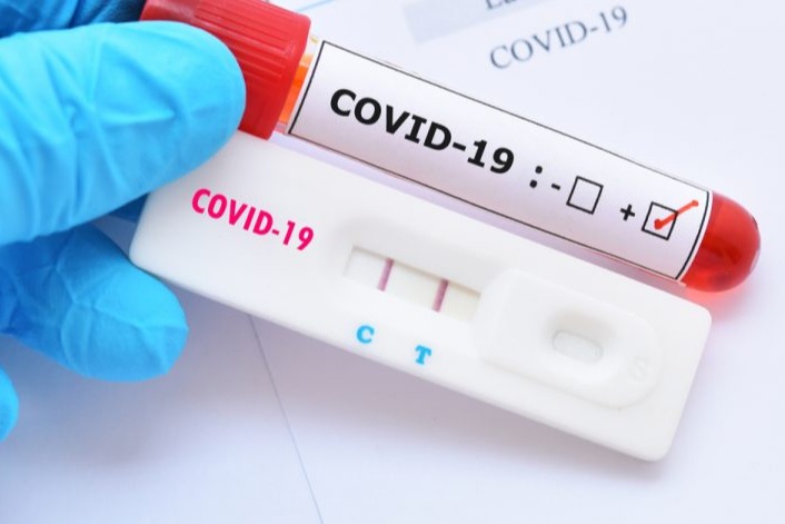 Exame de covid eleva custo do plano em 6 por cento